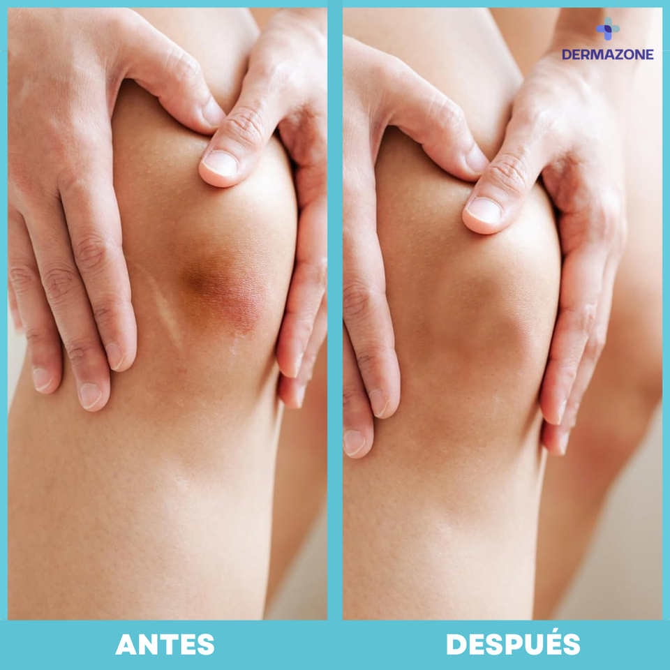 ROLLO HIDROCOLOIDE – CURACIÓN RÁPIDA PARA GRANOS, HERIDAS Y ROZADURAS