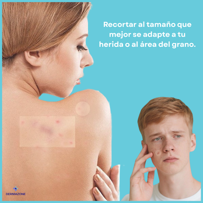 CURAROLL™ - (2 Unidades) Rollo Hidrocoloide Recortable para Granos, Espinillas, Rozaduras, Ampollas y Piel Superficial Irritada