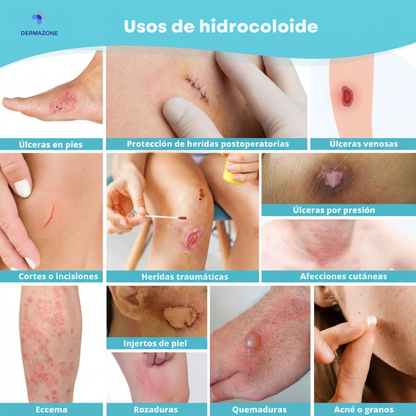 CURAROLL™ - (2 Unidades) Rollo Hidrocoloide Recortable para Granos, Espinillas, Rozaduras, Ampollas y Piel Superficial Irritada